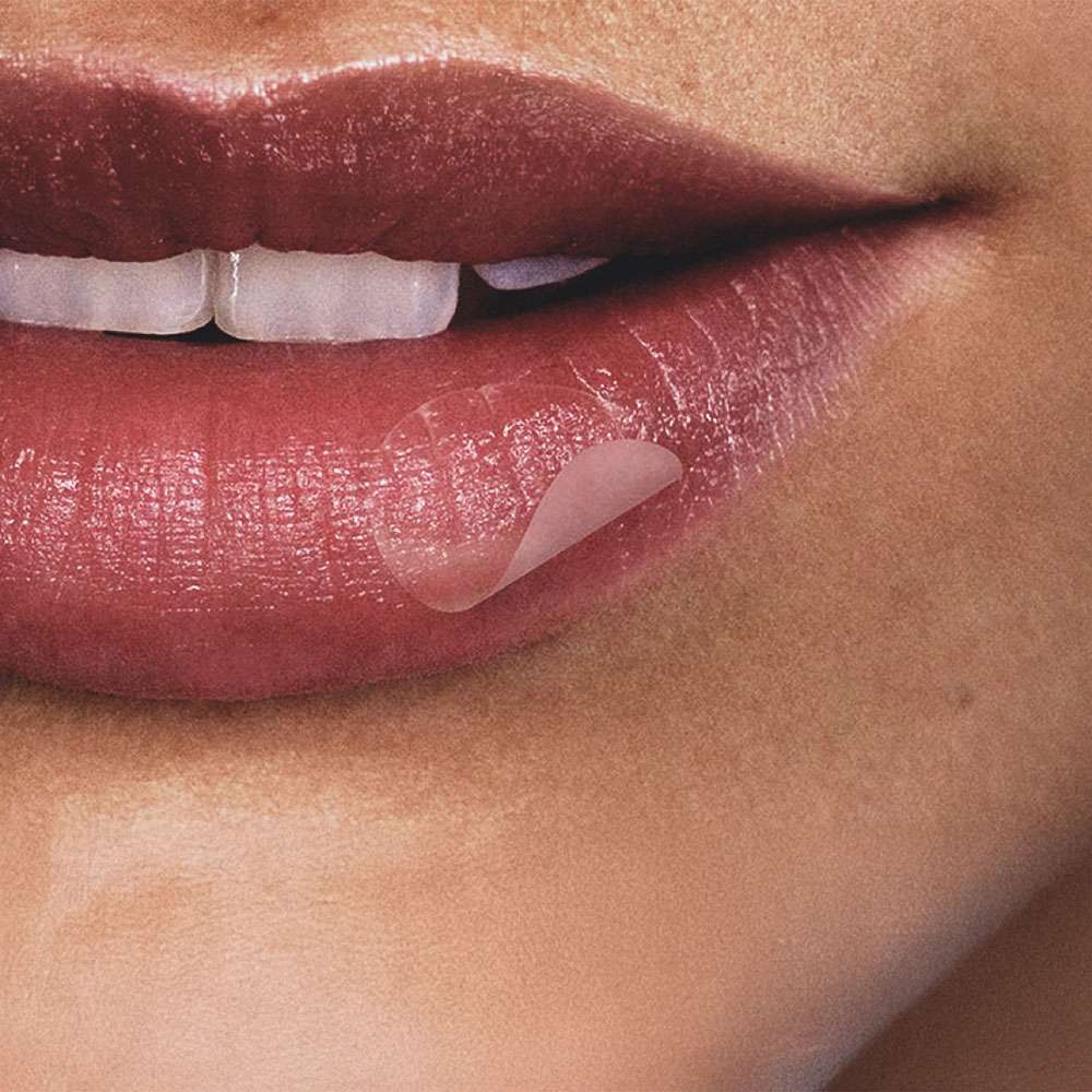 Lip with Herpes Patch on it