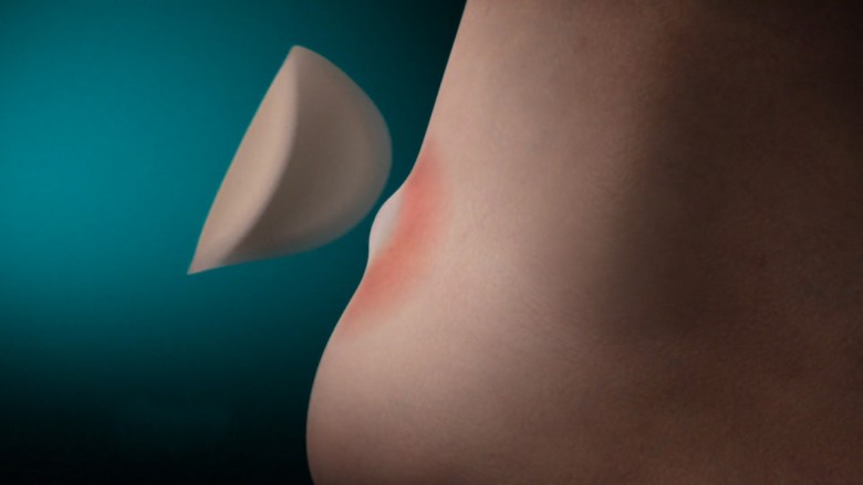 Hydrokolloidteknologi