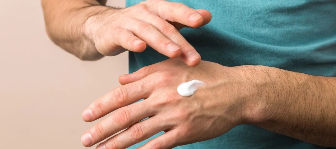Fingerrevner